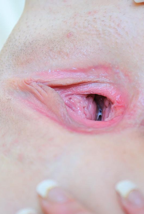 Ultra-Kinky Intrusion